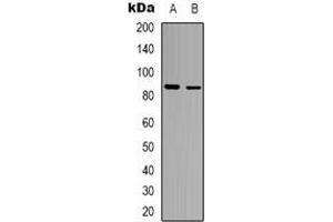 Western blot analysis of FRS2 expression in MCF7 (A), Hela (B) whole cell lysates. (FRS2 anticorps)