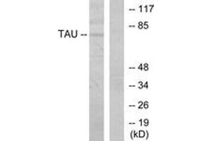 Western blot analysis of extracts from MDA-MB-435 cells, using Tau (Ab-205) Antibody. (tau anticorps  (AA 491-540))