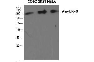 Western Blot analysis of various cells using Amyloid-β Polyclonal Antibody diluted at 1:2000. (beta Amyloid anticorps)