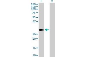 Western Blot analysis of FHL1 expression in transfected 293T cell line by FHL1 MaxPab polyclonal antibody. (FHL1 anticorps  (AA 1-280))