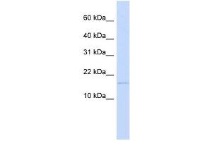 C3ORF18 antibody used at 1 ug/ml to detect target protein. (C3orf18 anticorps  (N-Term))