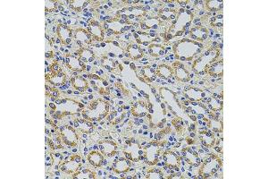 Immunohistochemistry of paraffin-embedded rat kidney using TRMT2A antibody. (TRMT2A anticorps)
