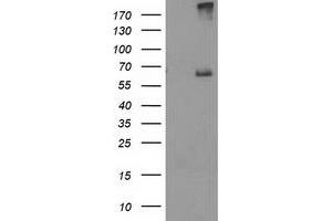 HEK293T cells were transfected with the pCMV6-ENTRY control (Left lane) or pCMV6-ENTRY RPN1 (Right lane) cDNA for 48 hrs and lysed. (RPN1 anticorps)