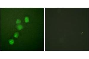 Immunofluorescence analysis of HuvEc cells, using Cyclin E1 (Ab-395) Antibody. (Cyclin E1 anticorps  (AA 361-410))