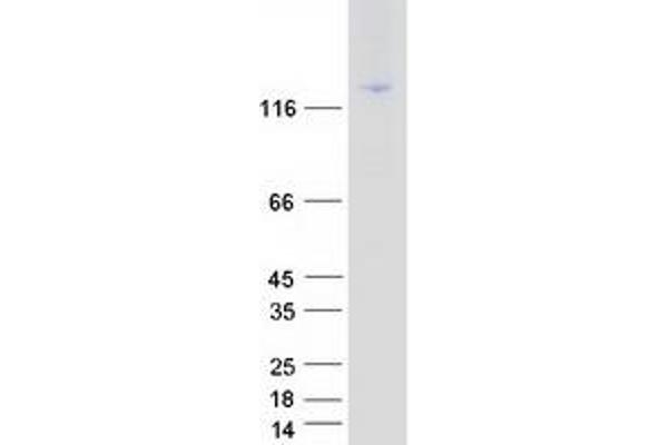 ITGAL Protein (Transcript Variant 1) (Myc-DYKDDDDK Tag)