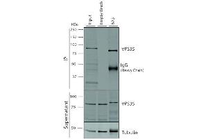 Immunoprecipitation analysis using Mouse Anti-VPS35 Monoclonal Antibody, Clone 8A3 (ABIN6932968). (VPS35 anticorps  (Biotin))