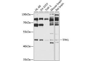 Western blot analysis of extracts of various cell lines, using TPH1 antibody (ABIN3022154, ABIN3022155, ABIN3022156 and ABIN6218634) at 1:1000 dilution. (Tryptophan Hydroxylase 1 anticorps  (AA 345-444))