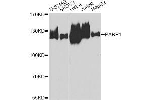 Western blot analysis of extracts of various cell lines, using PARP1 antibody (ABIN5975769) at 1/1000 dilution. (PARP1 anticorps)