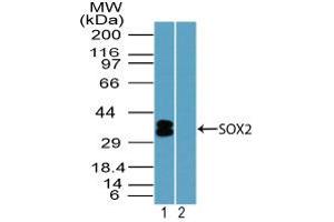 Image no. 1 for anti-SRY (Sex Determining Region Y)-Box 2 (SOX2) (AA 100-150) antibody (ABIN1490795) (SOX2 anticorps  (AA 100-150))