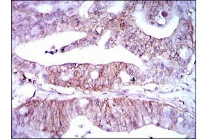 Immunohistochemistry (IHC) image for anti-Lipoprotein (Lp(a)) (AA 1823-2013) antibody (ABIN969533)