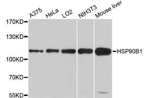 Western blot analysis of extracts of various cell lines, using HSP90B1 antibody (ABIN5970377) at 1/1000 dilution. (GRP94 anticorps)