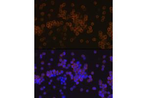 Immunofluorescence analysis of Raw 264 7 cells using PLC gamma 2 (PLC gamma 2 (PLCG2)) Rabbit mAb (ABIN7269342) at dilution of 1:100 (40x lens). (Phospholipase C gamma 2 anticorps)
