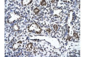 Rabbit Anti-ZNF148 Antibody       Paraffin Embedded Tissue:  Human alveolar cell   Cellular Data:  Epithelial cells of renal tubule  Antibody Concentration:   4. (ZNF148 anticorps  (Middle Region))