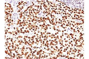 Image no. 1 for anti-Placenta Growth Factor (PGF) antibody (ABIN6189231) (PLGF anticorps)