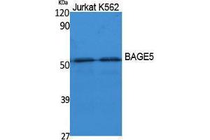 Western Blotting (WB) image for anti-B Melanoma Antigen Family, Member 5 (BAGE5) (N-Term) antibody (ABIN3178093) (BAGE5 anticorps  (N-Term))