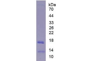 SDS-PAGE analysis of Human Lipase, Hepatic Protein. (LIPC Protéine)