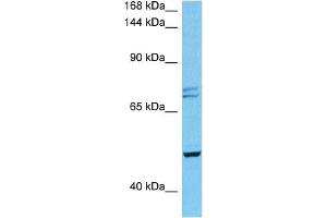 Host:  Mouse  Target Name:  PKD2  Sample Tissue:  Mouse Heart  Antibody Dilution:  1ug/ml (PKD2 anticorps  (N-Term))