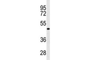 Western blot analysis of GATA6 antibody in WiDr lysate. (GATA6 anticorps  (AA 254-279))