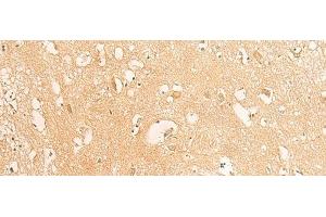 Immunohistochemistry of paraffin-embedded Human brain tissue using IFITM2 Polyclonal Antibody at dilution of 1:25(x200) (IFITM2 anticorps)