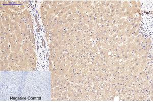 Immunohistochemical analysis of paraffin-embedded human liver tissue. (beta Catenin anticorps)