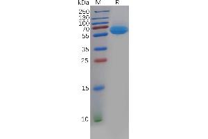 Human CD69 Protein, hFc Tag on SDS-PAGE under reducing condition. (CD69 Protein (CD69) (Fc Tag))