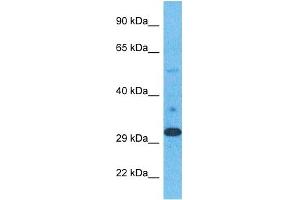 Host:  Rabbit  Target Name:  ELOV1  Sample Type:  Stomach Tumor lysates  Antibody Dilution:  1. (ELOVL1 anticorps  (N-Term))