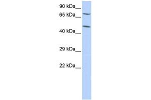 WB Suggested Anti-ZNF672 Antibody Titration:  0. (ZNF672 anticorps  (Middle Region))