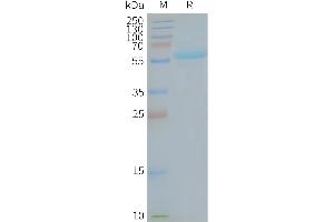 Human MA-Nanodisc, Flag Tag on SDS-PAGE (TMEM180 Protéine)