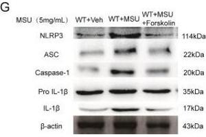 Western Blotting (WB) image for anti-NLR Family, Pyrin Domain Containing 3 (NLRP3) (AA 15-120) antibody (ABIN1386361)