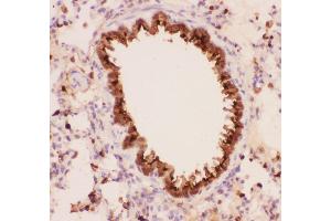 Anti-Annexin A1 Picoband antibody,  IHC(P): Rat Lung Tissue (Annexin a1 anticorps  (AA 2-346))