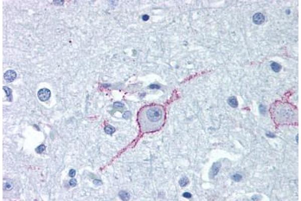 GALR3 anticorps  (Extracellular Domain)