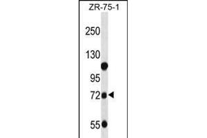 GUSB Antibody (C-term) (ABIN656383 and ABIN2845678) western blot analysis in ZR-75-1 cell line lysates (35 μg/lane). (Glucuronidase beta anticorps  (C-Term))