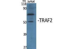 Western Blotting (WB) image for anti-TNF Receptor-Associated Factor 2 (TRAF2) (Internal Region) antibody (ABIN3177779) (TRAF2 anticorps  (Internal Region))
