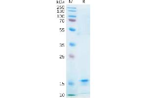 Human IL21 Protein, His Tag on SDS-PAGE under reducing condition. (IL-21 Protein (AA 30-162) (His tag))