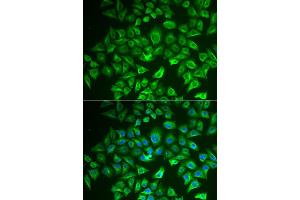 Immunofluorescence (IF) image for anti-Enoyl-CoA, Hydratase/3-Hydroxyacyl CoA Dehydrogenase (EHHADH) antibody (ABIN1980240) (EHHADH anticorps)