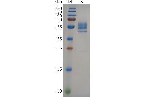 Human TNF Protein, hFc Tag on SDS-PAGE under reducing condition. (DR3/LARD Protein (AA 25-199) (Fc Tag))
