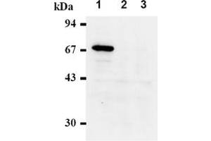 Western Blotting (WB) image for anti-Checkpoint Kinase 2 (CHEK2) antibody (ABIN487488) (CHEK2 anticorps)