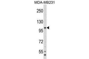 Image no. 1 for anti-Complement Component 6 (C6) (N-Term) antibody (ABIN452791) (C6 anticorps  (N-Term))