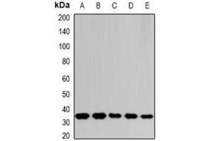 Western blot analysis of THOC1 expression in SHSY5Y (A), SW620 (B), NIH3T3 (C), mouse spleen (D), rat liver (E) whole cell lysates. (THOC1 anticorps)