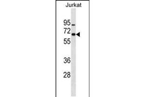 Western blot analysis in Jurkat cell line lysates (35ug/lane). (ZNF358 anticorps  (N-Term))