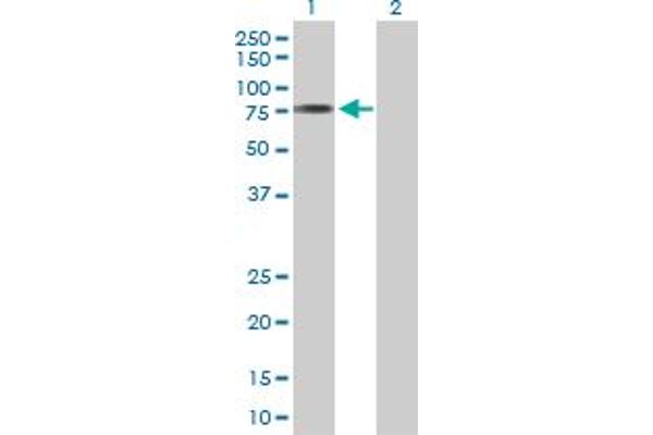 ACSM3 anticorps  (AA 1-586)