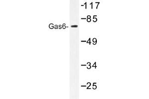 Image no. 1 for anti-Growth Arrest-Specific 6 (GAS6) antibody (ABIN317613) (GAS6 anticorps)