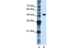 WB Suggested Anti-DDX47 Antibody Titration:  0. (DDX47 anticorps  (N-Term))