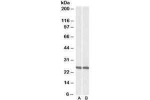 Western blot testing of mouse [A] and rat [B] brain lysate with UCHL1 antibody at 0. (UCHL1 anticorps)
