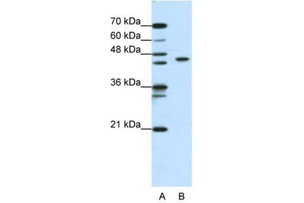 ZBTB9 anticorps  (N-Term)