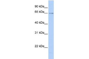 WB Suggested Anti-PPIL2 Antibody Titration: 0. (PPIL2 anticorps  (C-Term))