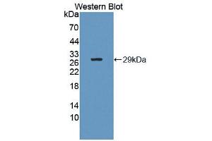 Figure. (CD101 anticorps  (AA 566-784))