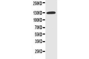 Anti-NKCC1 antibody, Western blotting WB: HELA Cell Lysate (SLC12A2 anticorps  (N-Term))