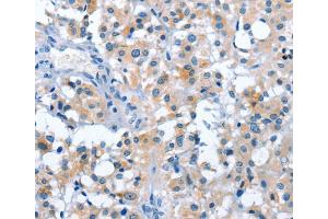 Immunohistochemistry (IHC) image for anti-Ankyrin Repeat and SOCS Box-Containing 2 (ASB2) antibody (ABIN2422959) (ASB2 anticorps)