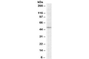 Western blot testing of K562 lysate with TRIP6 antibody at 2ug/ml. (TRIP6 anticorps)